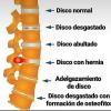 Rehabilitación Fisica